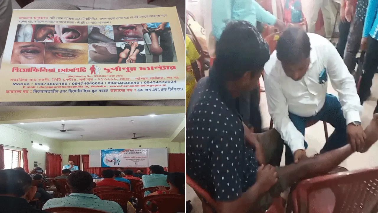 দুর্গাপুরে হিমোফিলিয়ার সোসাইটির বিশেষ অনুষ্ঠান