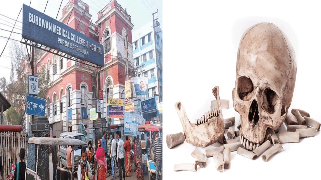 হাড্ডি? কঙ্কাল পাচারের আতুর ঘর বর্ধমান মেডিক্যালে?