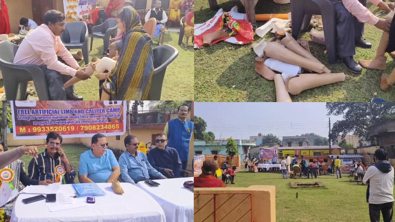 দুর্গাপুরে অঙ্গহীন ব্যক্তিদের কৃত্রিম অঙ্গ প্রদান