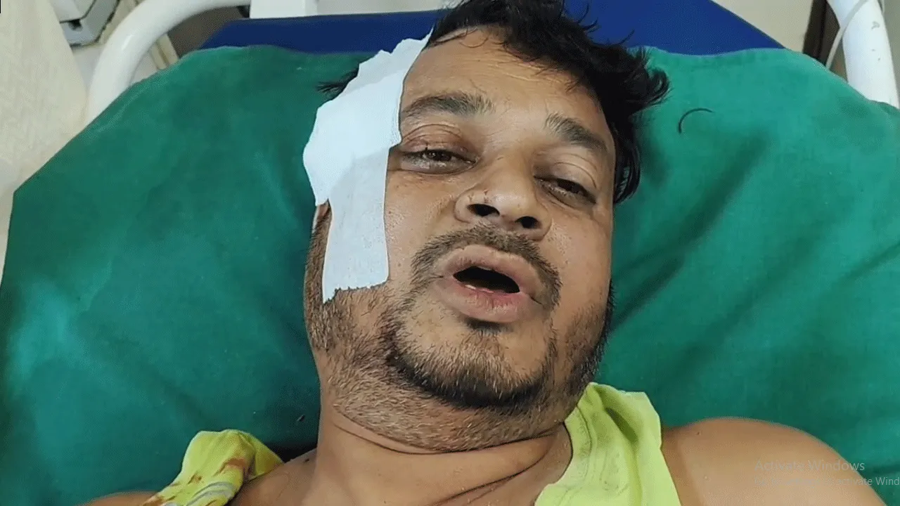 দুর্গাপুরে প্রিয়জনের ময়নাতদন্ত করাতে গিয়ে তৃণমূল কর্মীদের হাতে আক্রান্ত বিজেপি নেতা