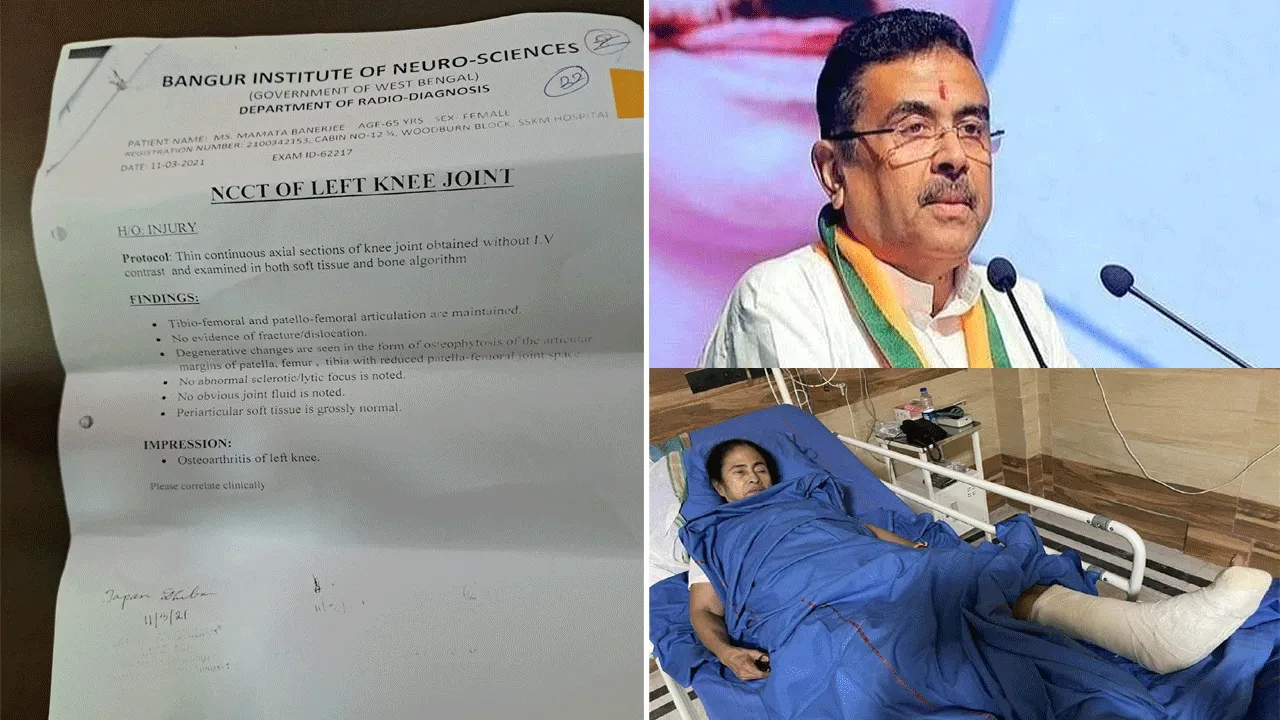 নন্দীগ্রামের ‘পা ভাঙা’ বিতর্কে ফের বিস্ফোরক শুভেন্দু অধিকারী
