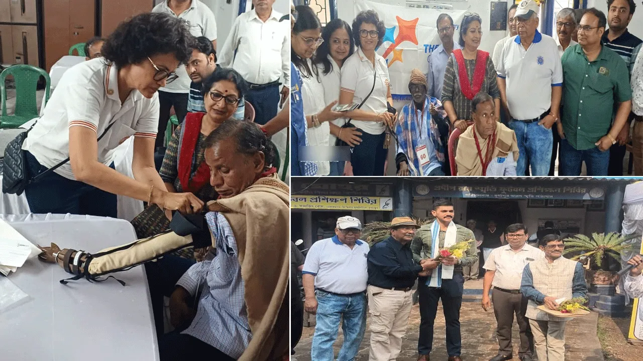 দুর্গাপুরে বিনামূল্যে কৃত্রিম অঙ্গ প্রদান শিবির