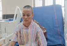 বৃহৎ আকারের মস্তিষ্কের টিউমার অস্ত্রোপচার, নজির সরকারি মেডিক্যাল কলেজের