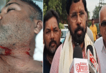দুর্গাপুরে বিজেপি নেতার উপর হামলা, চাঞ্চল্য